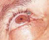 The Eye
