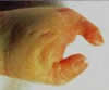 Two little Finger