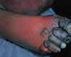 Dirty Feet ba toh!!?