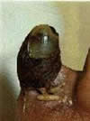 Finger