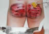 torture 4