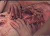 KILL 5